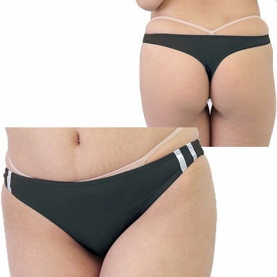 �Q�������X�g���b�`�u���}�s�o�b�N�@�u���b�N�i�����W�F���[�j